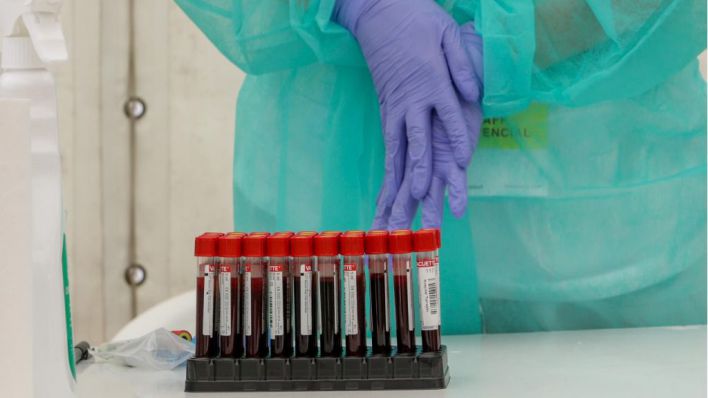 88 nuevos contagios, 48 más que ayer, en una jornada sin muertos
